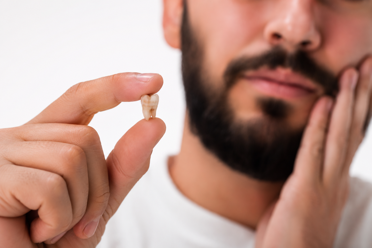 Wisdom Teeth Removal