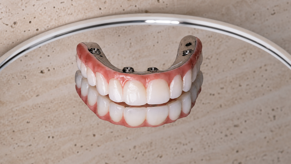 All-on-4 Dental Implants