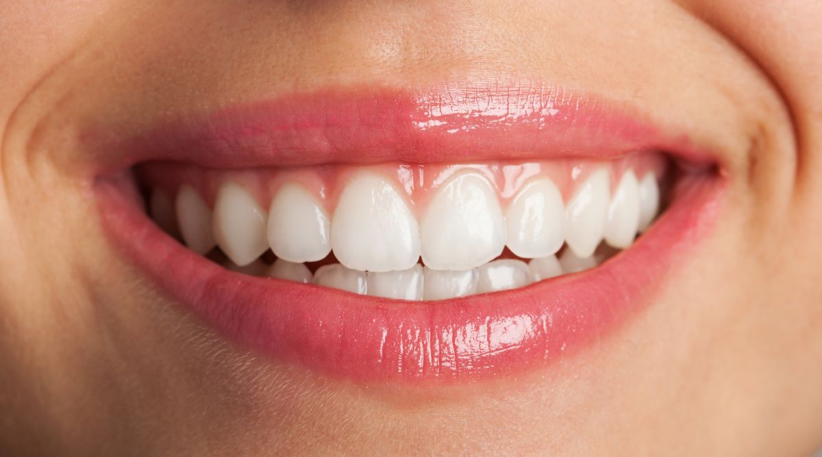 Teeth Whitening