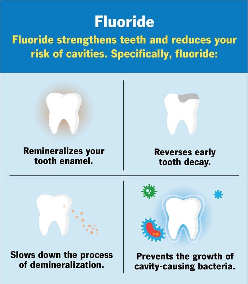 Fluoride treatment in Pickering diagram showing how fluoride remineralizes enamel, reverses early decay, slows demineralization, and prevents cavity-causing bacteria