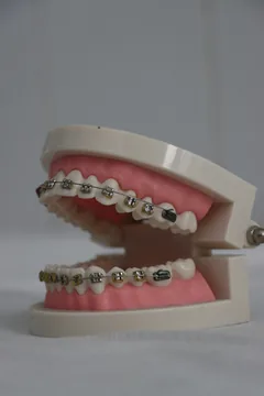 Invisalign