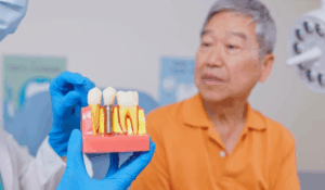 Dental implants treatment planning consultation at Bayly Dental Clinic in Pickering